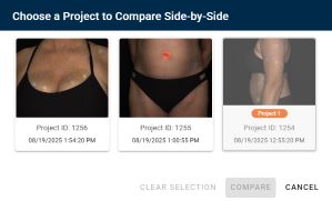 Select Comparison